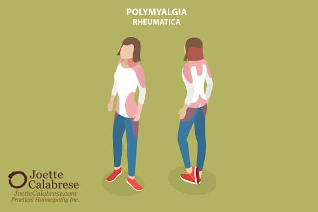 Joette Calabrese, Pain From Out of Nowhere? Practical Homeopathy® Counters Polymyalgia Rheumatica