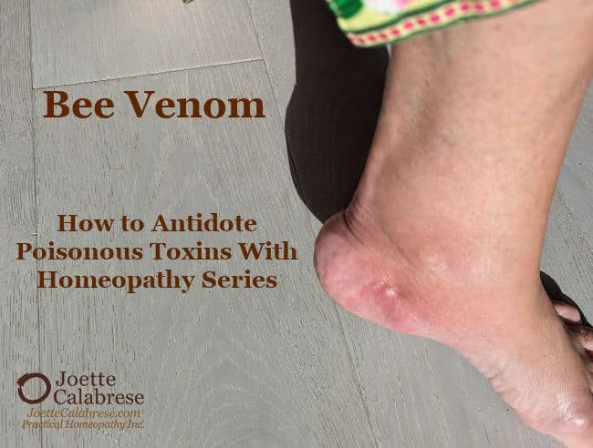 Joette Calabrese, Practical Homeopathy®, 6. Bee Venom: How to Antidote Poisonous Toxins With Homeopathy Series