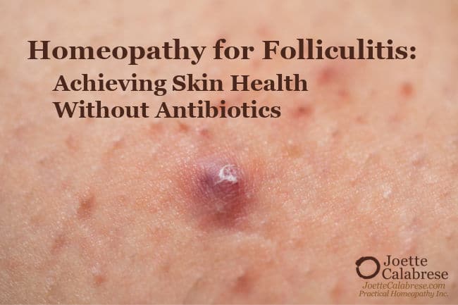 Joette Calabrese, Practical Homeopathy®, Homeopathy for Folliculitis: Achieving Skin Health Without Antibiotics